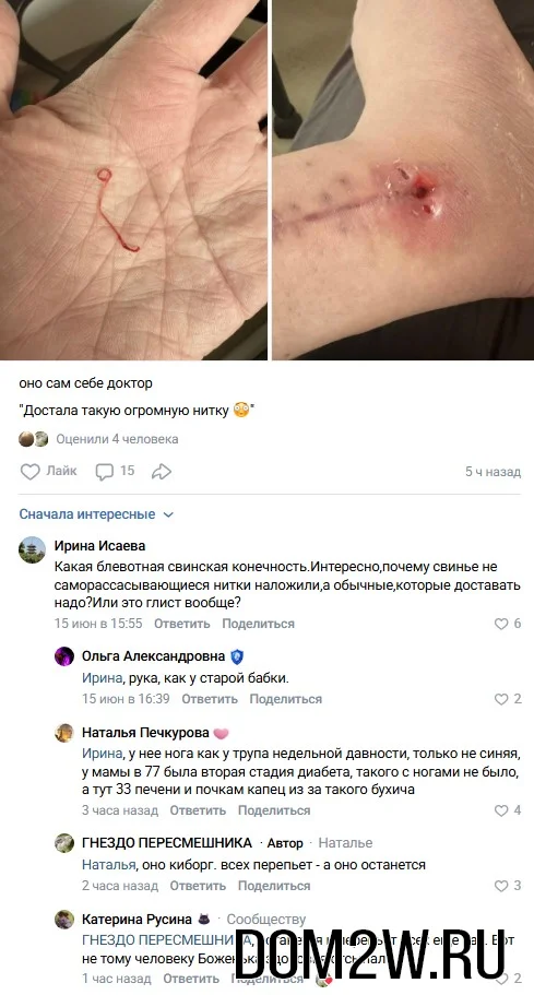 Болячка на теле Александры Черно